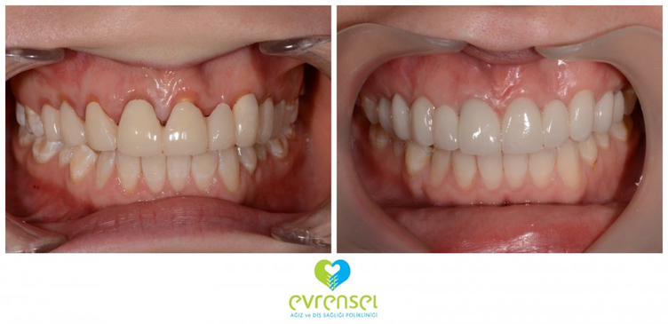 Slider image (9) Evrensel Dental Clinic in Ankara Turkey